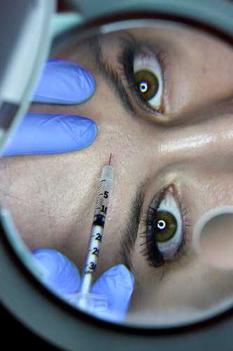 botox injection by Bella Medspa botox photo